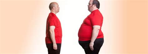 gastric bypass beverly hills|Gastric Bypass Beverly Hills .